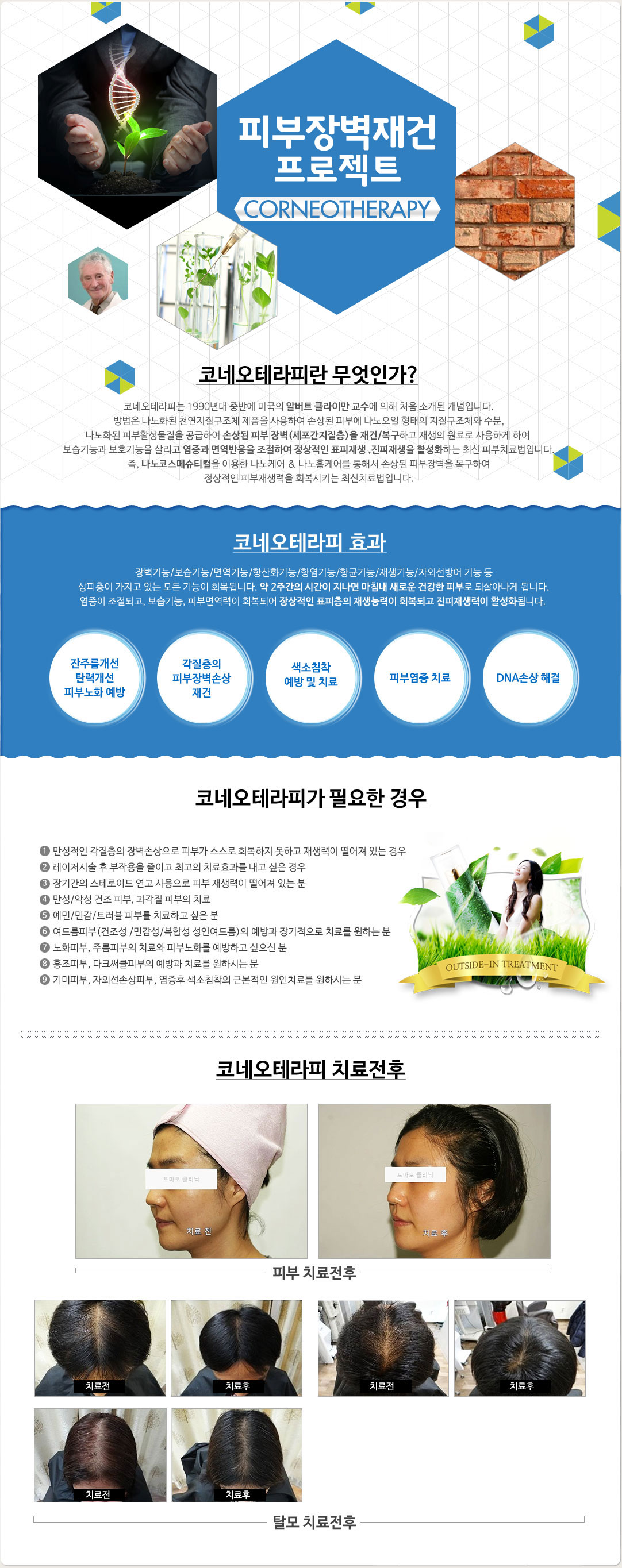 코니오테라피 효과,코니오테라피 치료전후,나노테라피 제품